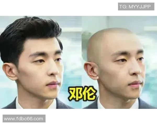 足球明星剃光头震撼亮相引热议,粉丝纷纷猜测背后原因和未来发展